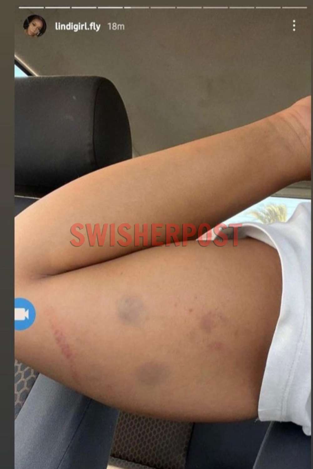 heavy k baby momma assault Lindiwe bruised arm