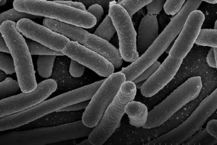 E. coli outbreak UK South African expats